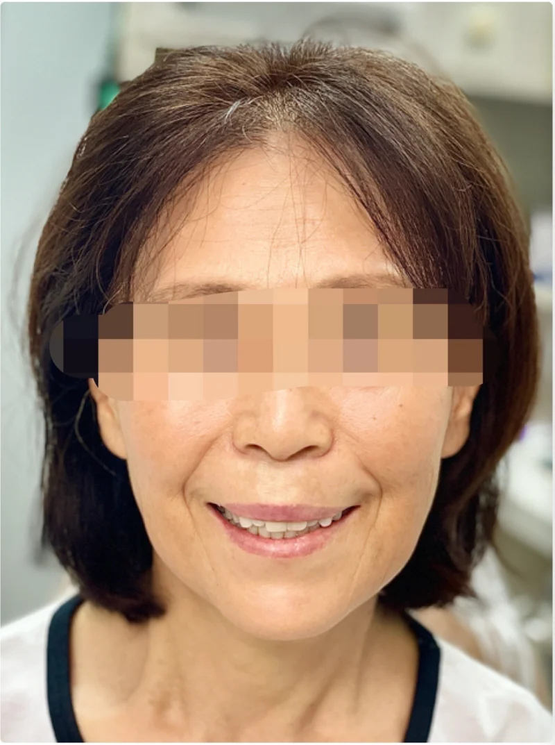 Before treatment: Cosmetic Dentistry patient at Premier Dental